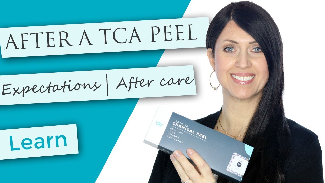 After TCA Peel | What to Expect | Flaking | Discoloration | Healing | FAQ's