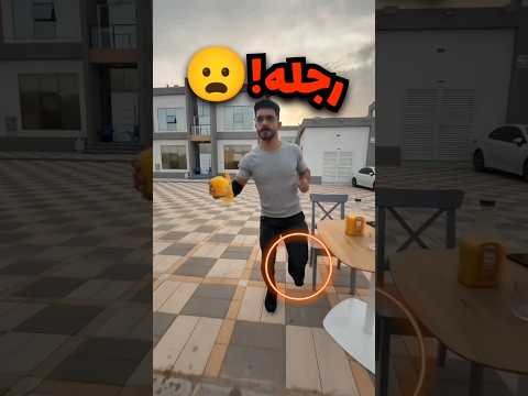 طلب عصير وقله جيبلي اياه لسيارة بس مايدري ان رجله مقطوعة شوفو