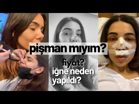 Video: Hayranlar estetik ameliyattan sonra Priluchny'yi tanımadı ve Dava ile karıştırdı