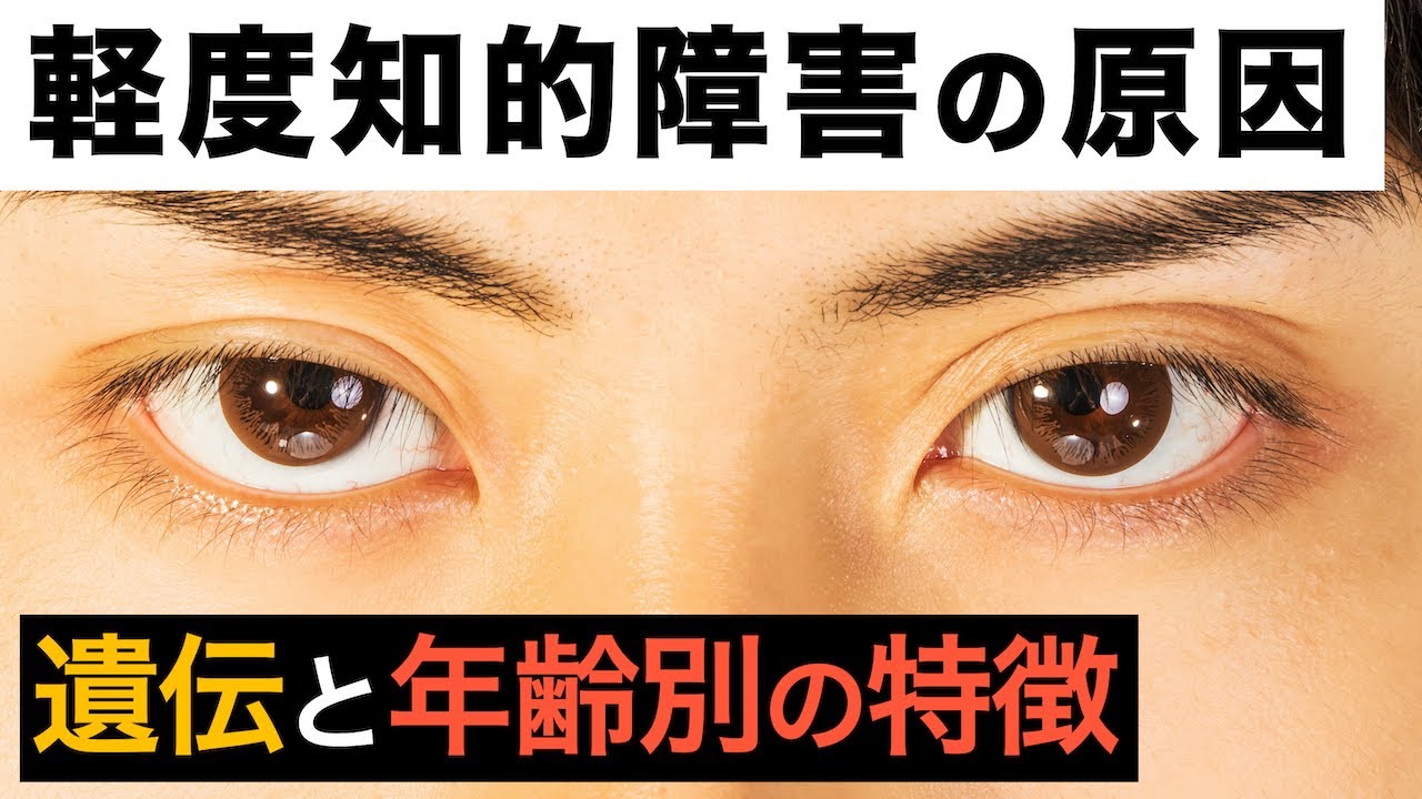 軽度知的障害【※遺伝や特徴について】