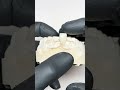 🦷 Metallfreie Interimsprothese – leicht, ästhetisch & verträglich