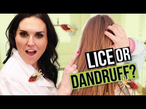 Dandruff or Head Lice? How to tell the Difference