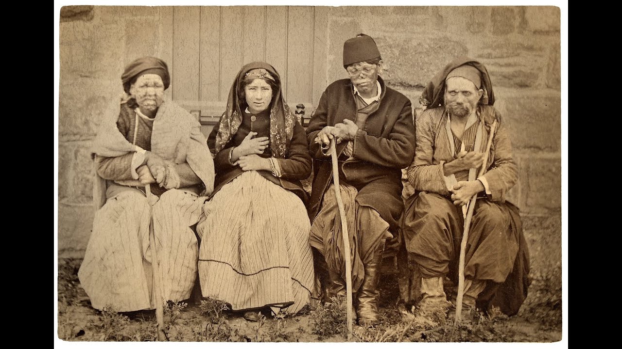 10ο ΕΠ. 6η ΣΕΖΟΝ: ΛΕΠΡΟΚΟΜΕΙΟ ΛΕΥΚΩΣΙΑΣ, Η 