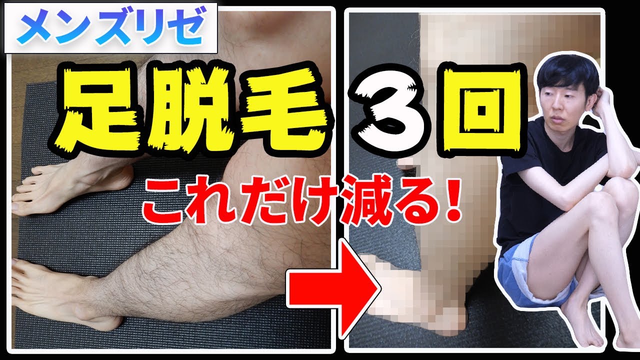 メンズの足 すね毛の脱毛料金が安いのは 総額費用が安いおすすめを紹介 メンズリリ