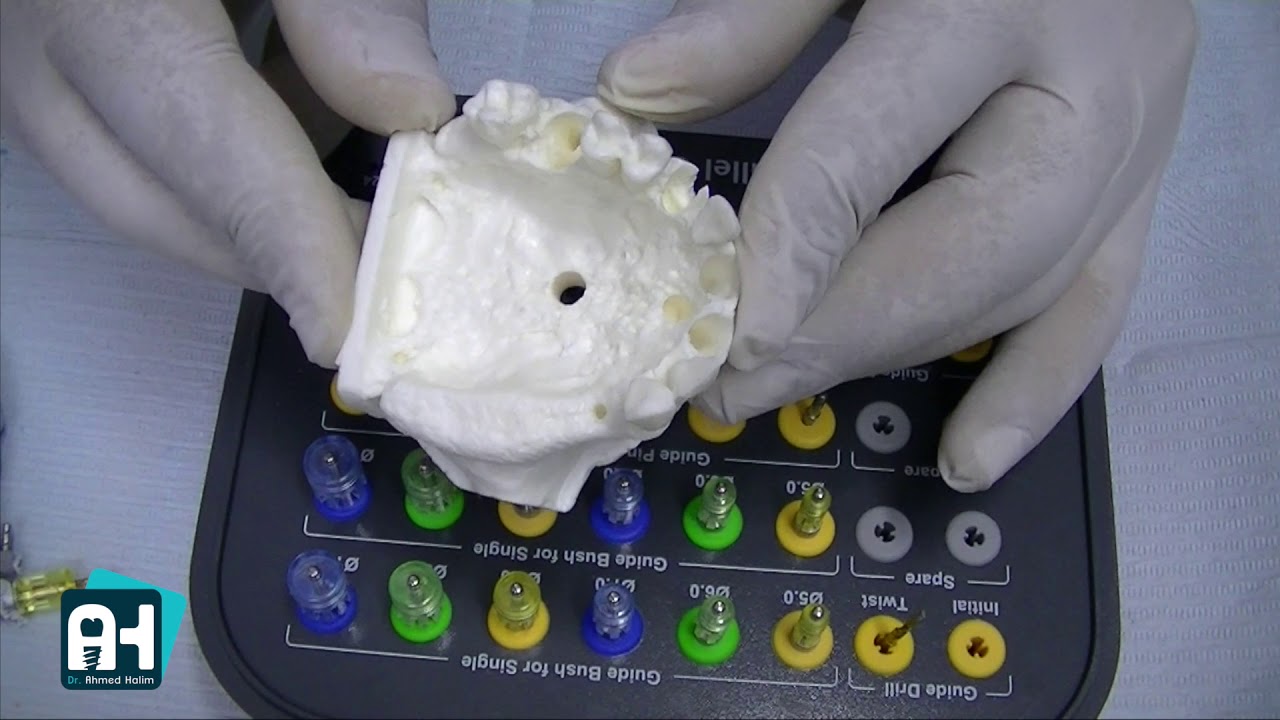 Dental Implant Kits Episode 1 YouTube