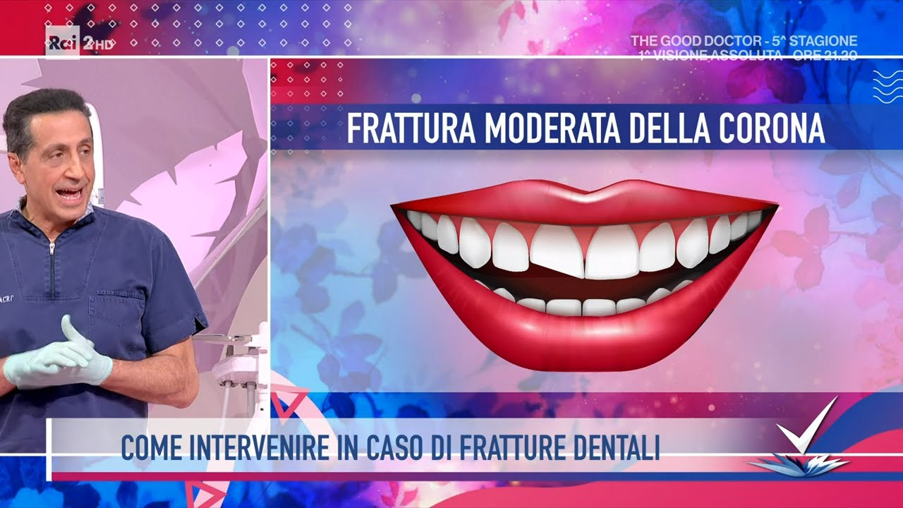 Giovanni Macrì - Le fratture dentali - Detto Fatto 09/02/2022