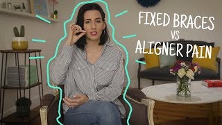 Fixed braces vs. aligners pain: my experience