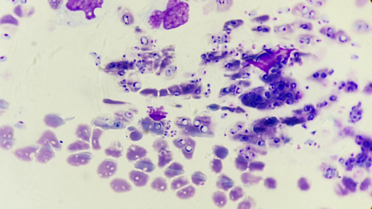 Babesia gibsoni Heavy infection from puppy blood - YouTube