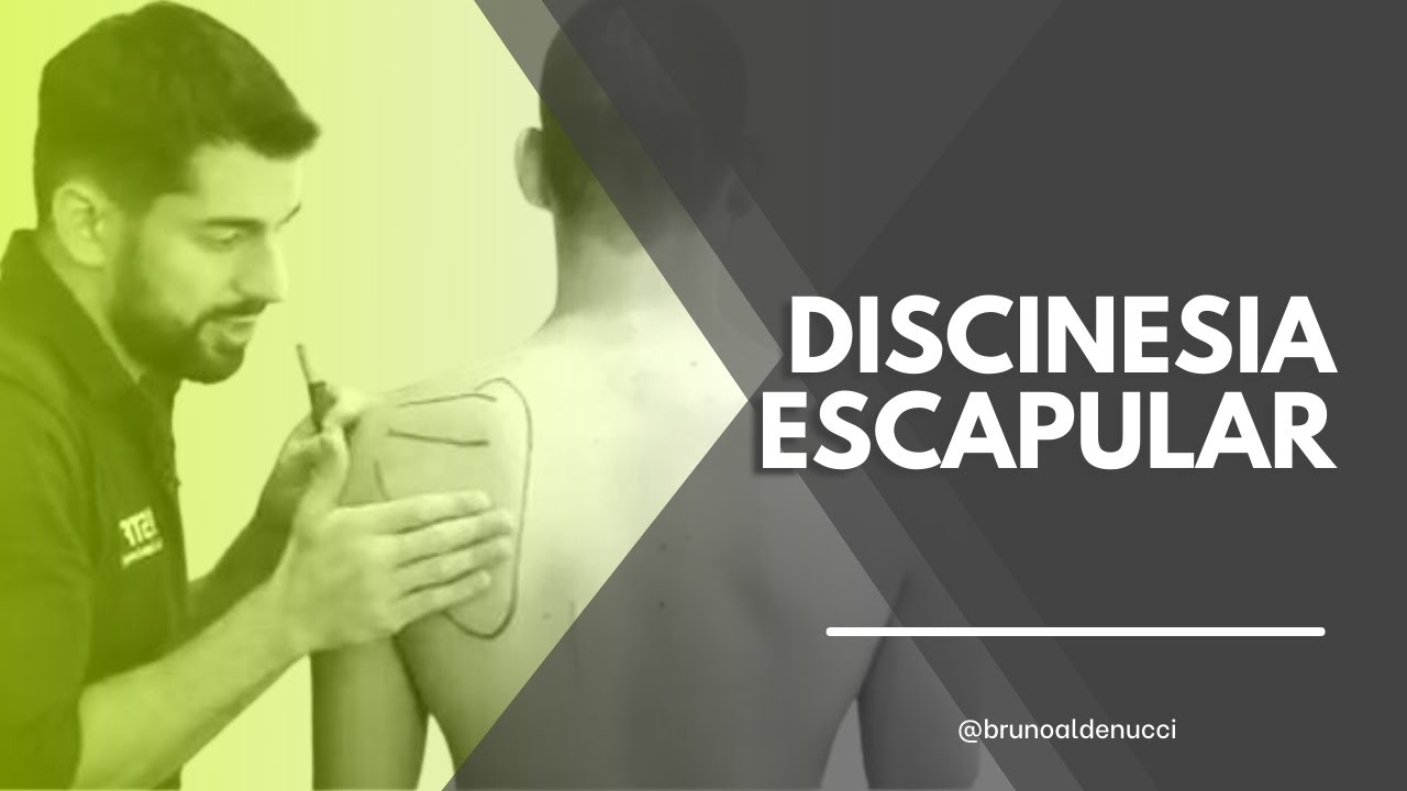 Discinesia escapular