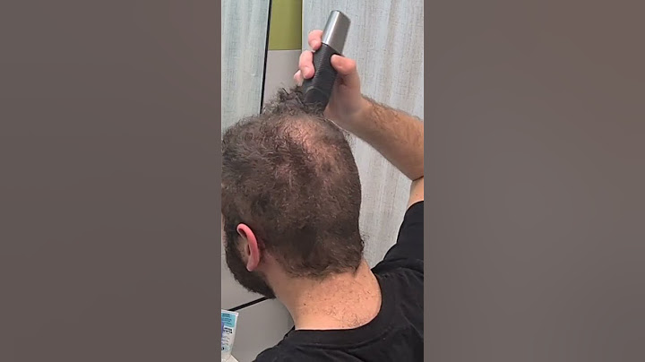 Curly Balding Hair Buzz Cut Transformation