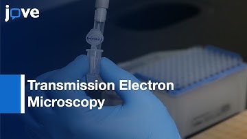 Sample Preparation & Imaging of Exosomes By Transmission Electron Microscopy l Protocol Preview