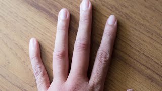 how to get rid of swollen fingers in the morning