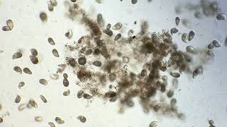 Ciliate Explosion in Detritus