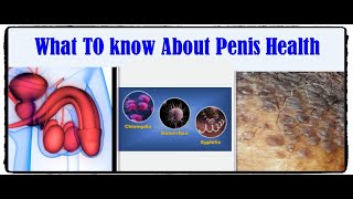 How to keep your penis healthy and strong..كيف تحافظ على قصيب سليم وقوى وخالى من اى مرض