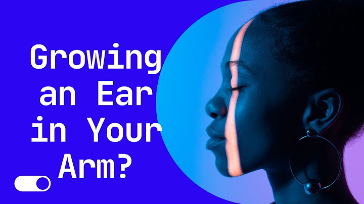Growing an Ear in Your Arm?