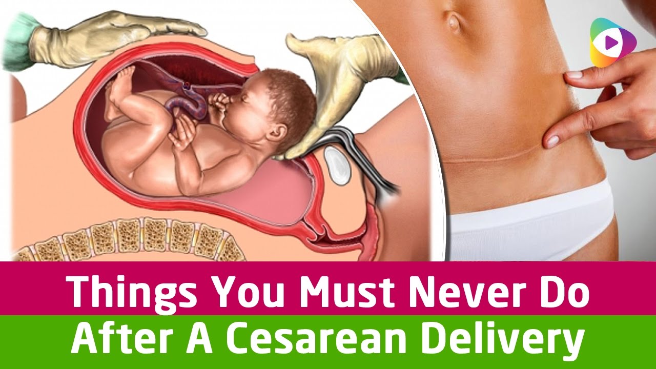 things-you-must-never-do-after-a-cesarean-delivery-pregnancy-baby