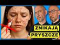 #1 Sposób Na Pozbycie Się Trądzika i Chorób Skóry