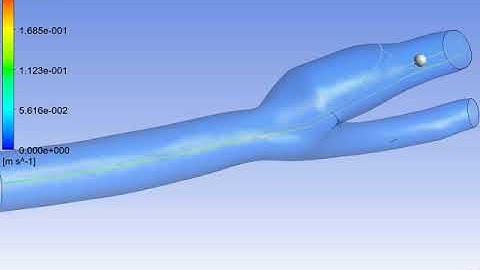 blood flow through bifurcating arteries
