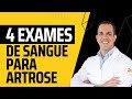 4 exames de sangue para quem tem artrose