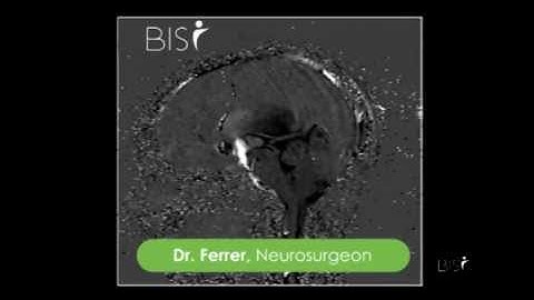 Dr. Ferrer - Dynamic MRI - CSF circulation