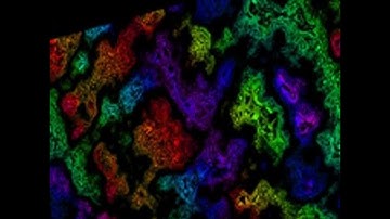 A General Introduction to Psychoanalysis by Sigmund FREUD read by Various Part 2/3 | Full Audio Book