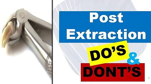 DENTAL POST EXTRACTION INSTRUCTIONS