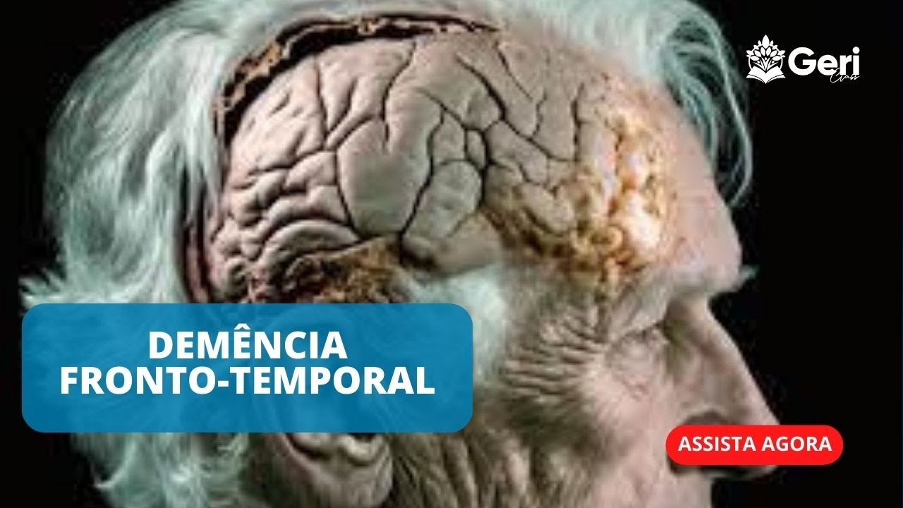 PodCast #3 - Demência Fronto-Temporal