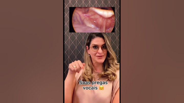 São minhas cordas vocais?