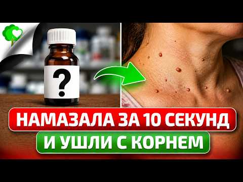 My friend was RADIANT after getting rid of her papillomas! A collection of PROVEN remedies for pa...