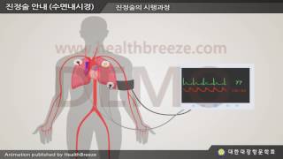 [Demonstration] c0040acko Korean Society of Coloproctology Sedation Intraocular Sleep Endoscopy