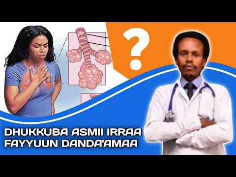 Dhukkuba Asmii Irraa Fayyuun Danda Amaa Asthma