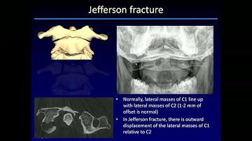 Imaging Skeletal trauma