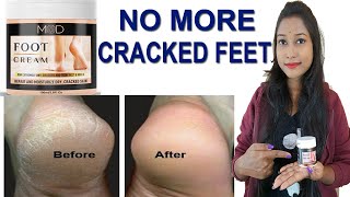 Mod Foot Cream for Cracked Heel | Treatment For Dry and Cracked Hell screenshot 1