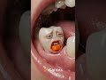 🦷 “4 Foods Your Teeth Secretly Need”