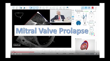 TEE simulator - Mitral Valve Prolapse