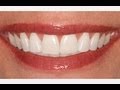 Photoshop Tutorial: How to Brighten & Whiten TEETH!