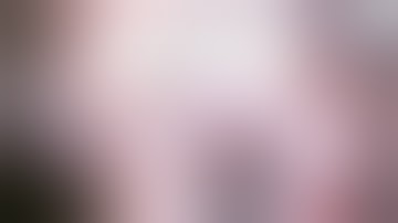 Treatment of IOL subluxation using the flange