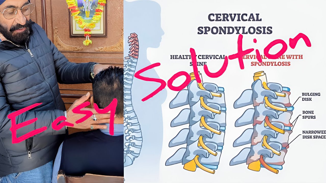 Cervical Problem 👉 Easy Solution 