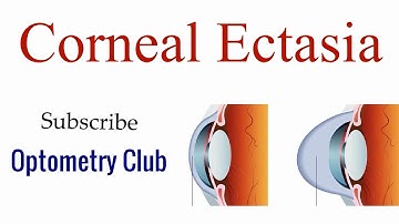 Corneal Ectasia Introduction - Optometry Club