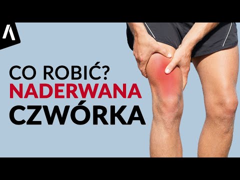 Naderwany mięsień czworogłowy uda I Co robić?