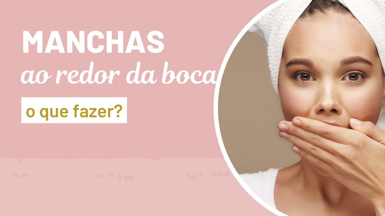 Manchas ao redor da boca, o que fazer...