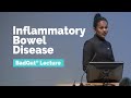 BadGut®Lecture: Inflammatory Bowel Disease (IBD)