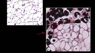 6.2 A&P Lab Connective Tissue
