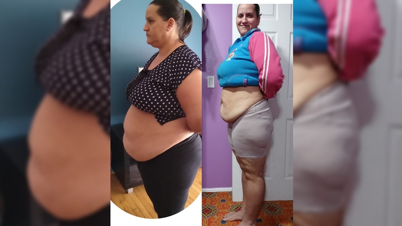 Antes e depois 36 kg off reeducação alimentar