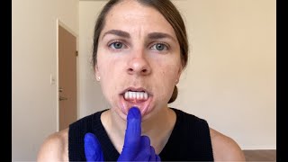 Tongue and Lip Ties  Myofunctional Therapy SelfAssessment