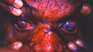 5 САМЫХ СТРАШНЫХ БОЛЕЗНЕЙ-УБИЙЦ ЧЕЛОВЕЧЕСТВА 5 САМЫХ СТРАШНЫХ БОЛЕЗНЕЙ-УБИЙЦ ЧЕЛОВЕЧЕСТВА
