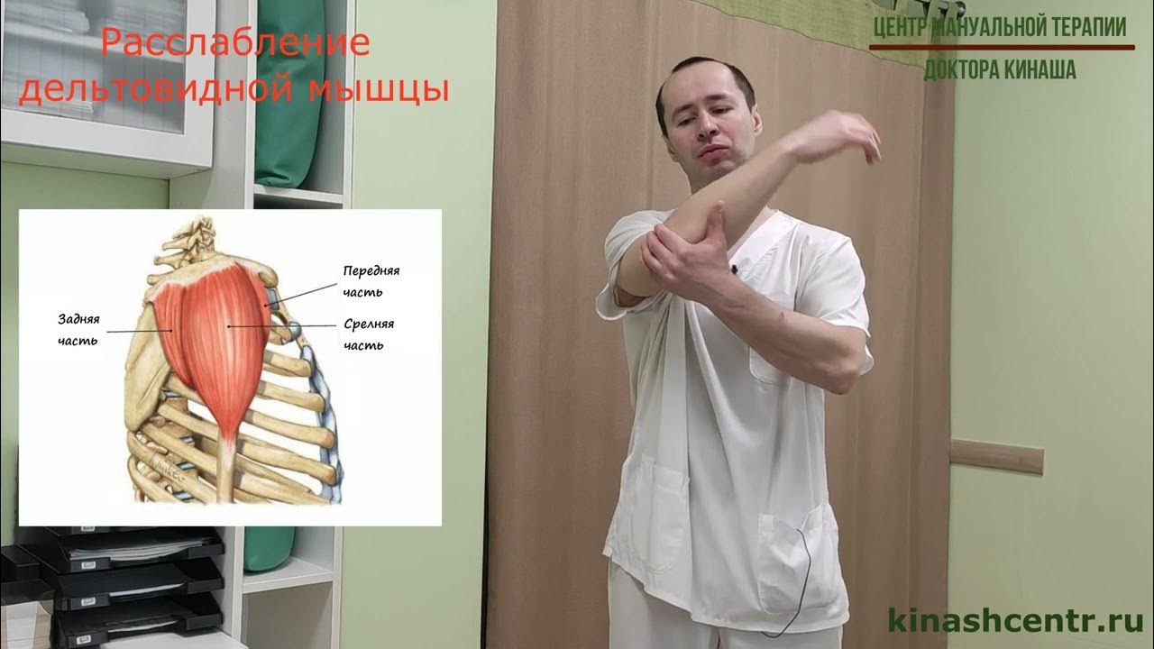 Триггерные точки плеча