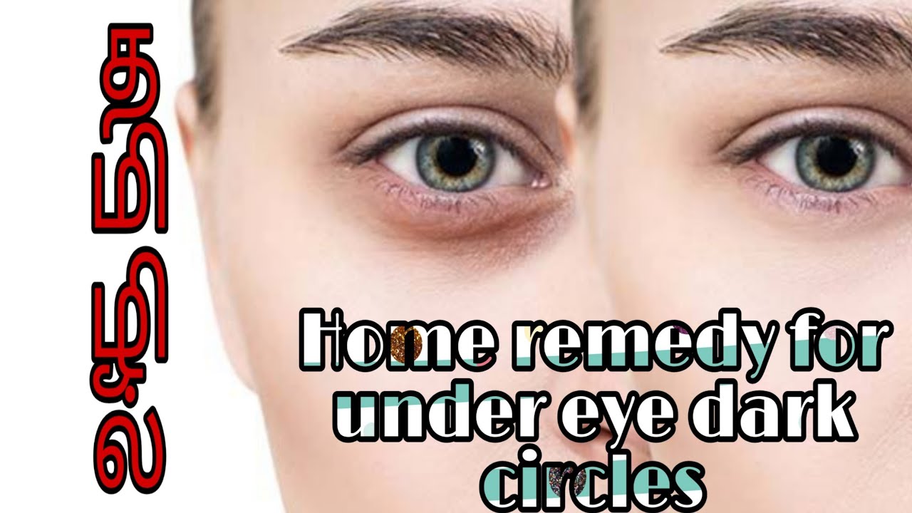remove black circles under eyes home remedy