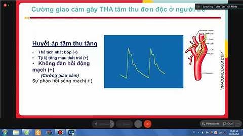 Chẹn beta trong thực hành lâm sàng - Những câu hỏi cần lời giải đáp [Phần 1] - 26 Aug