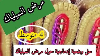 وضعية إدماجية حول مرض السيلياك علوم طبيعية رابعة متوسط